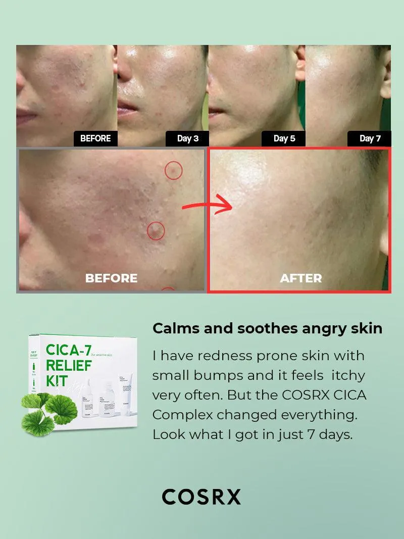 CICA-7 RELIEF KIT- 3 step